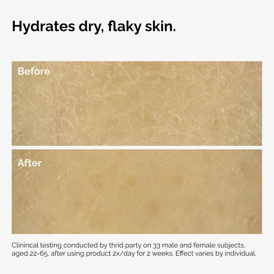the-body-care-collection-e8 ord-natural-moisturizing-factors-inulin-body-before-after-graphic-02.jpg