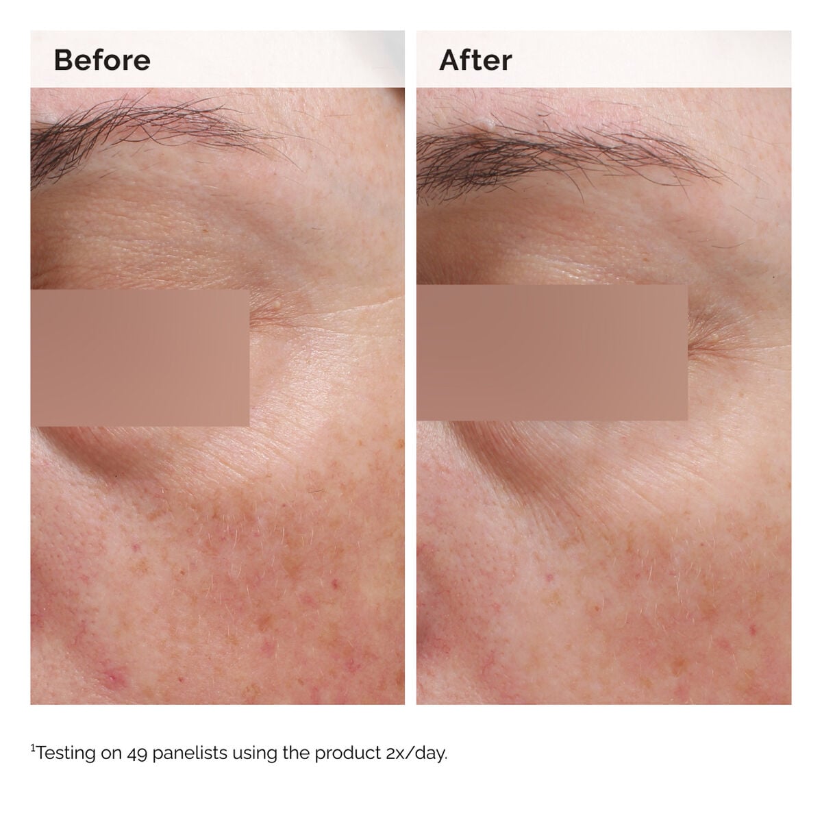 niacinamide-5-face-and-body-emulsion-b4 2024-08-23-ORD-Nia-5pct-Face-Body-B-A-Elasticity-Global-02-1x1.jpg