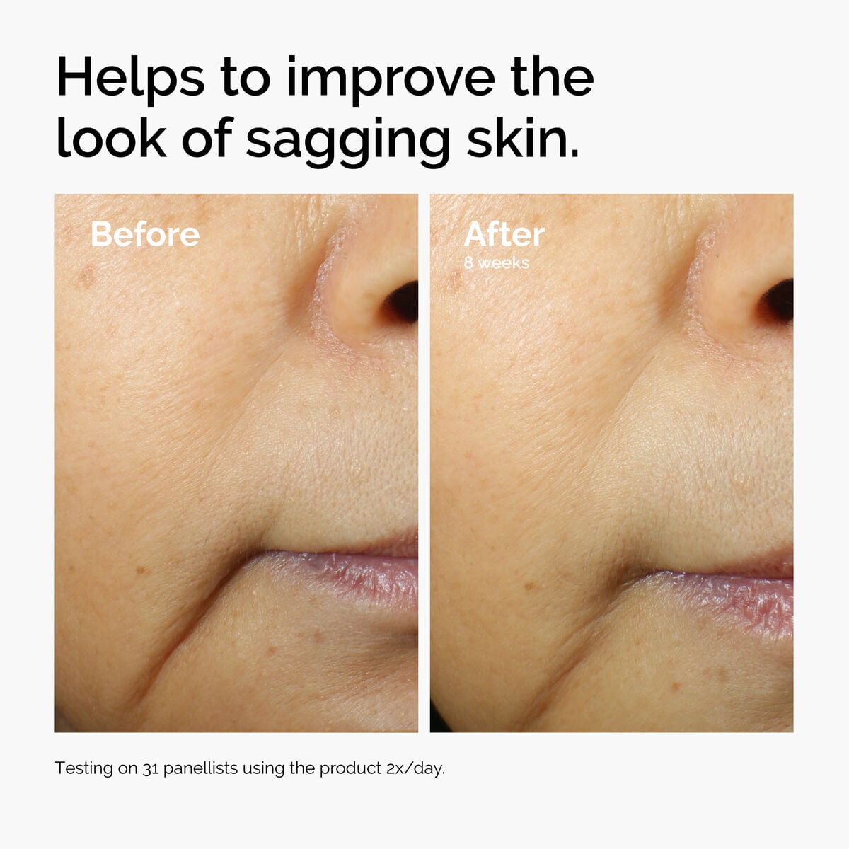 caffeine-3-escin-1-face-serum-v2 ord-caffeine-3pct-escin-1pct-face-serum-before-after-sagging.jpg