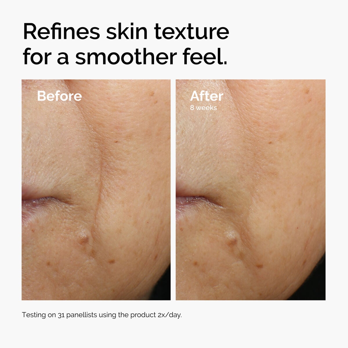 caffeine-3-escin-1-face-serum-v2 ord-caffeine-3pct-escin-1pct-face-serum-before-after-texture.jpg