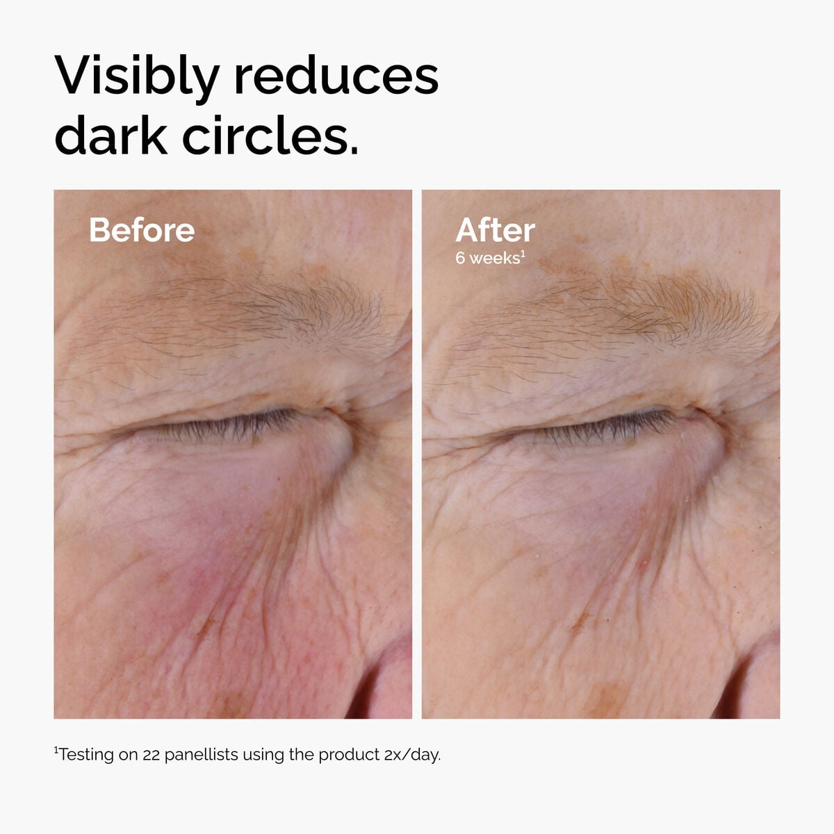caffeine-solution-5-egcg-eye-serum-j4 ord-caffeine-solution-egcg-dark-circles-before-after.jpg