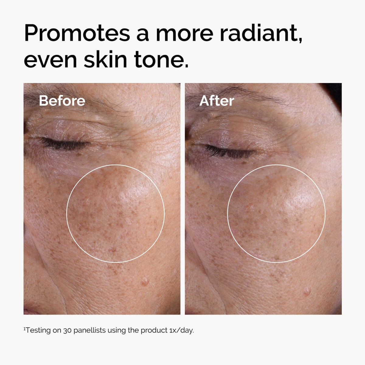 glycolic-acid-7-exfoliating-toner-j5 ord-glycolic-before-after-radiance.jpg