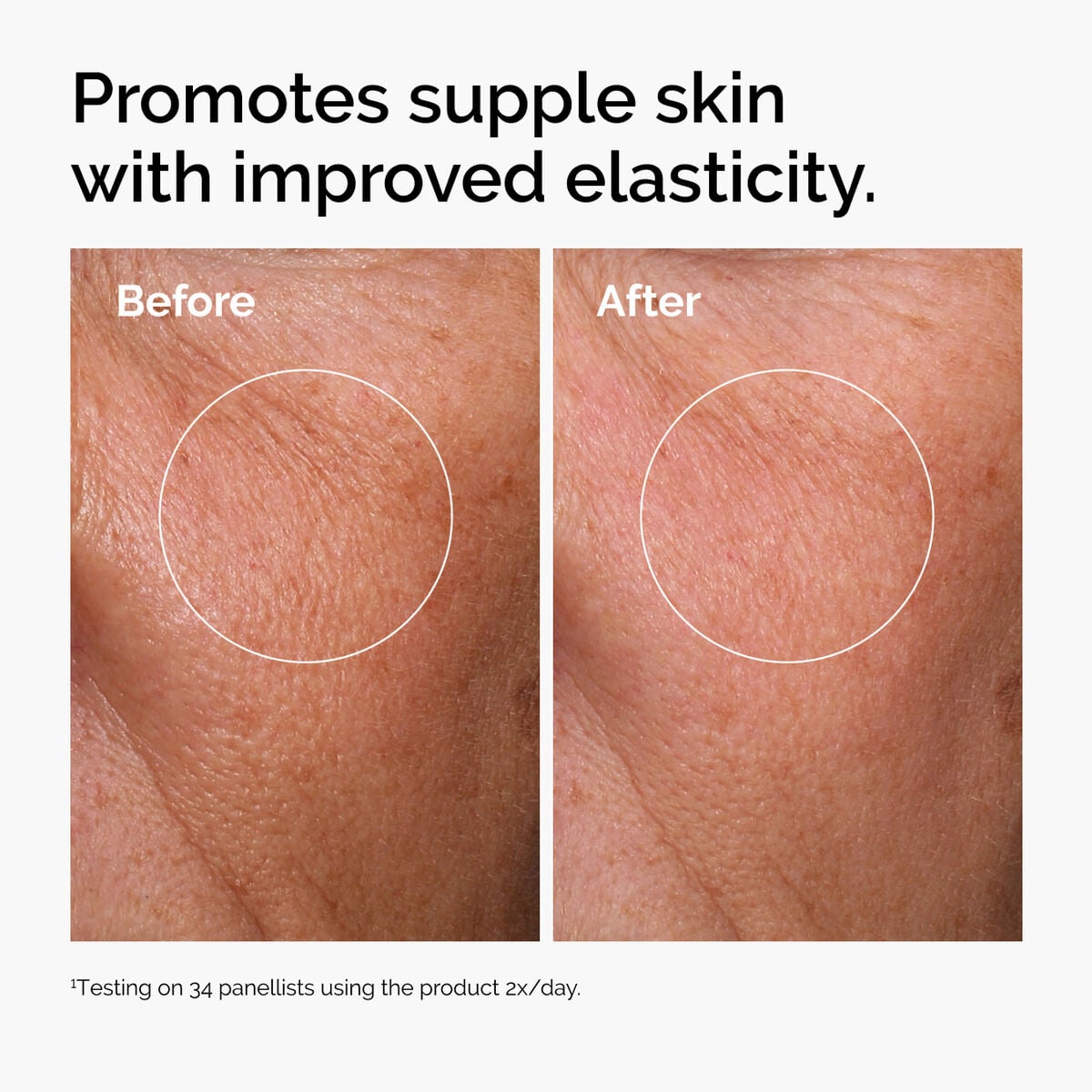 hyaluronic-acid-2-b5-with-ceramides-f5 ord-hyaluronic-acid-2pct-b5-hydrating-serum-before-after-elasticity.jpg