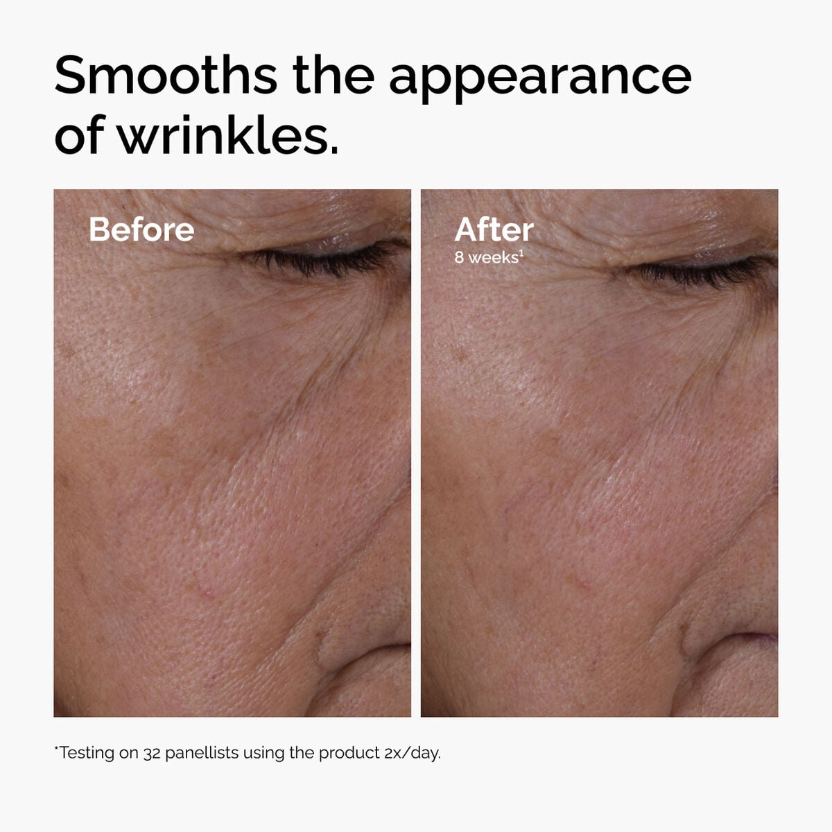multi-peptide-ha-serum-w4 ord-multi-peptide-ha-serum-wrinkles-before-after.jpg