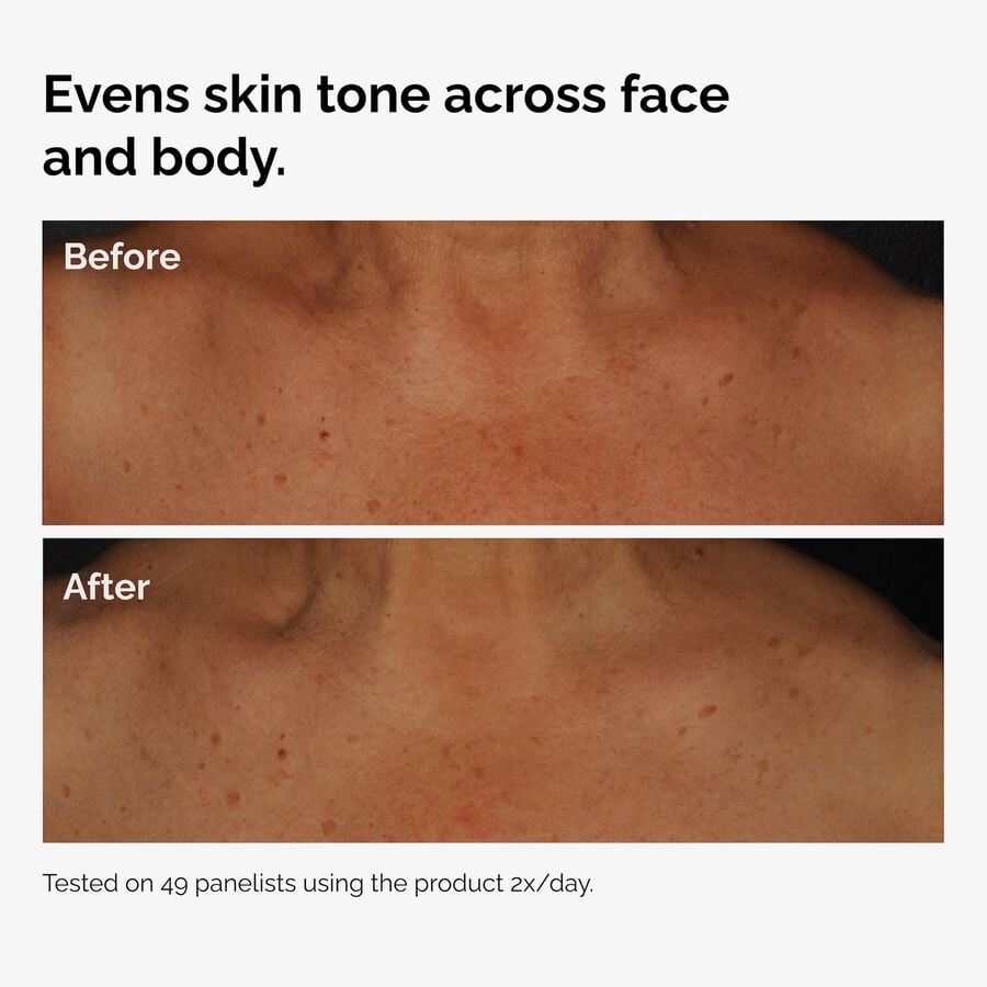 the-body-care-collection-e8 ord-niacinamide-face-body-serum-before-after-even-tone-graphic.jpg