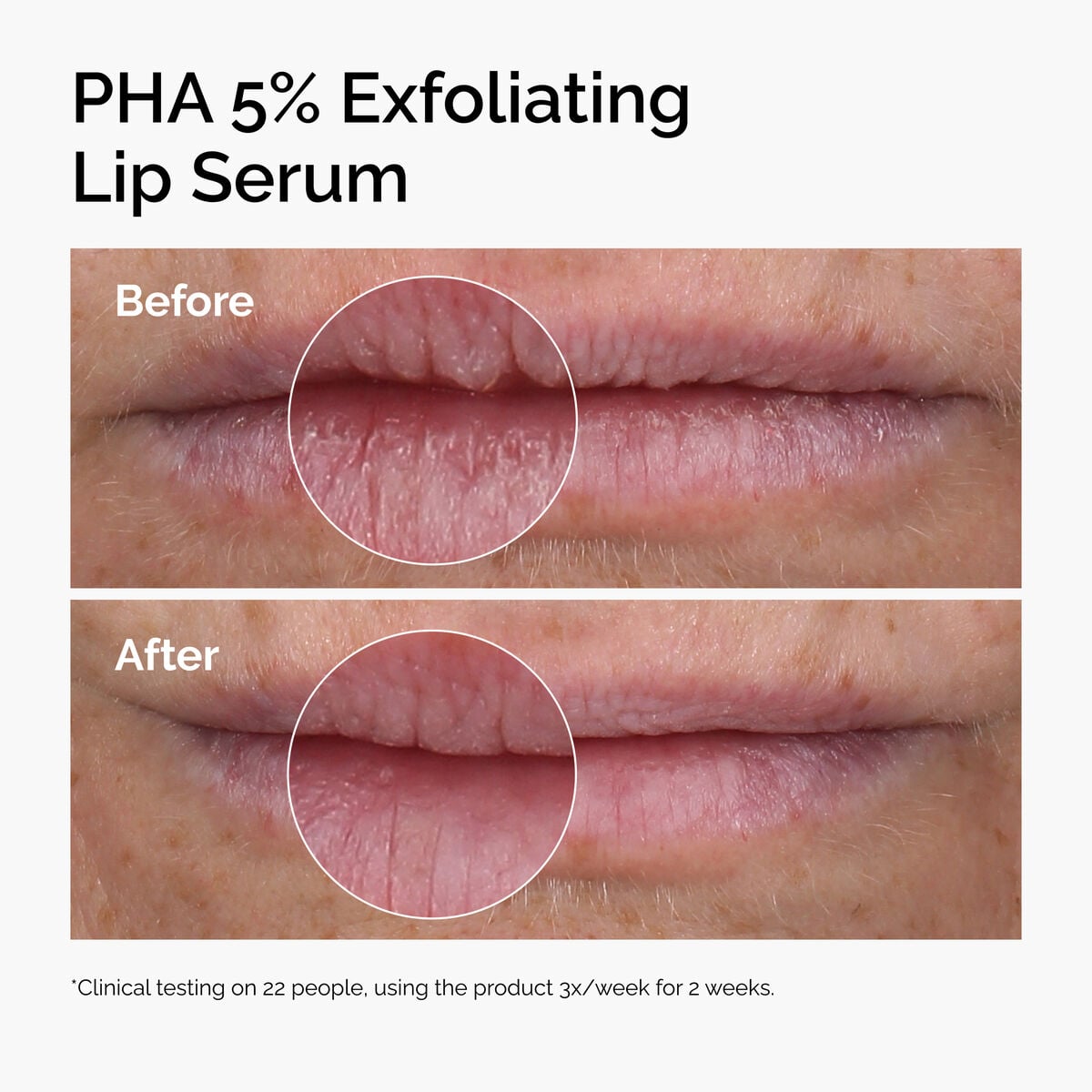 pha-5-exfoliating-lip-serum-s8 ord-pha-5pct-lip-exfoliating-serum-before-after.jpg